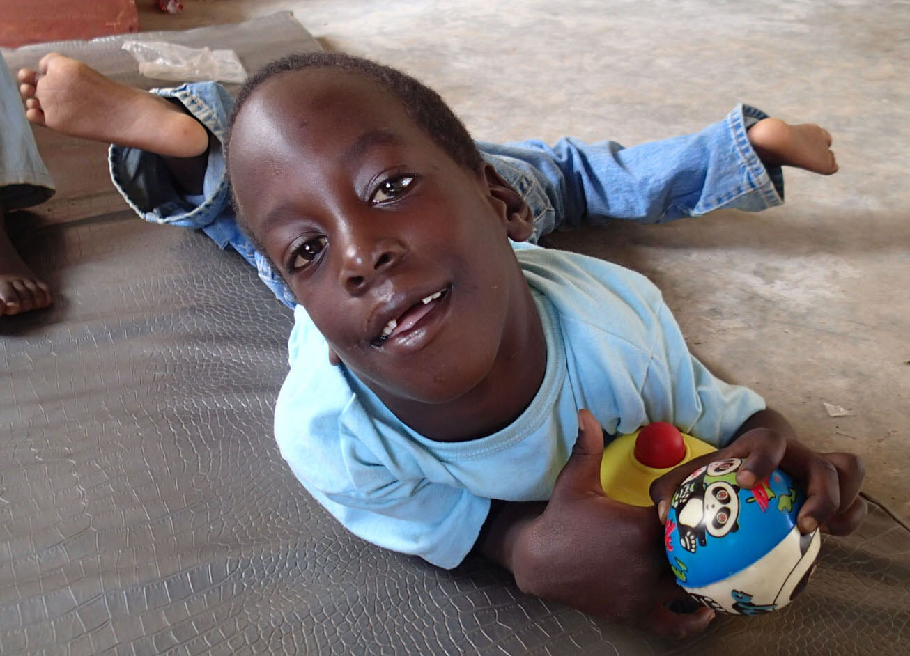 What Is Cerebral Palsy: Signs, Symptoms, Prevention, and Treatment Options in Uganda and Africa. 